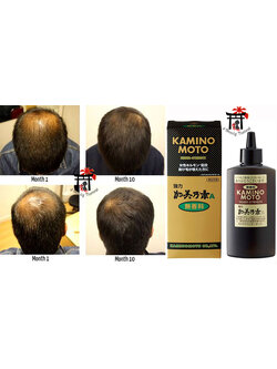 Strong Kaminomoto A Tonic (Higher Strength - Hair Regrowth) เซรั่มปลูกผมจากธรรมชาติ (สูตรไม่มีกลิ่น) ป้องกันผมร่วงและผมบาง (ฉลากญี่ปุ่น) 150 มล.