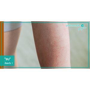 "ขน" คืออะไร ?