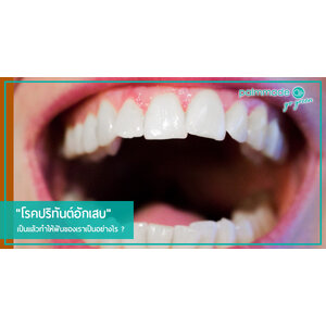 "โรคปริทันต์อักเสบ" เป็นแล้วทำให้ฟันของเราเป็นอย่างไร ?