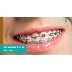 ลักษณะฟัน 7 แบบที่ควร "จัดฟัน"