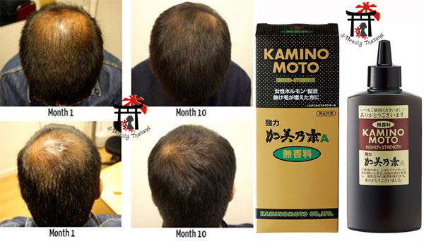 Strong Kaminomoto A Tonic (Higher Strength - Hair Regrowth) เซรั่มปลูกผมจากธรรมชาติ (สูตรไม่มีกลิ่น) ช่วยป้องกันผมร่วงและผมบาง เร่งการเจริญเติบโตของเส้นผม ช่วยเพิ่มผมงอกใหม่ (ฉลากญี่ปุ่น) 150 มล.