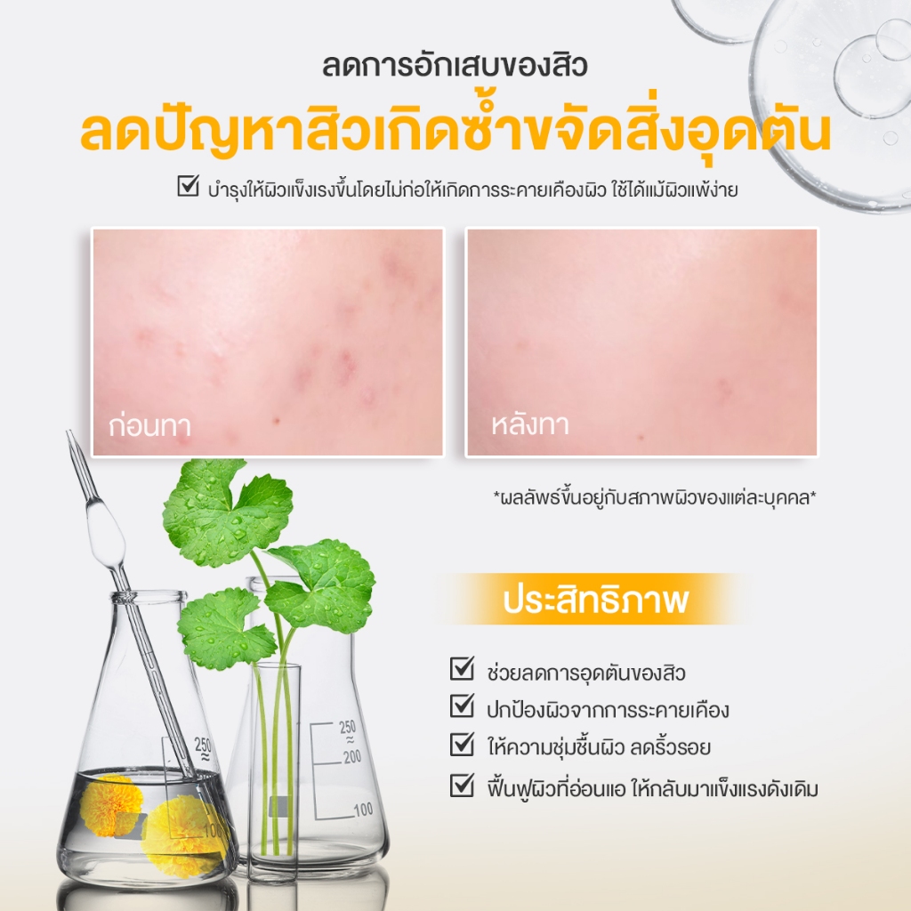 (แบบหลอด) Jula's Herb Marigold Intensive Clear Gel 40 ml. จุฬาเฮิร์บ เจลลดสิวดาวเรือง แก้ทุกสิว ผิวหน้าใส (1 หลอด 40 มล.)