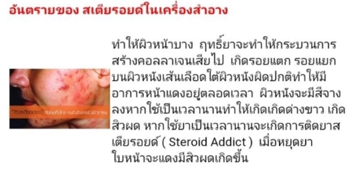 ชุดทดสอบสารสเตียรอยด์ในเครื่องสำอาง ขนาด 10 ตัวอย่างเทส