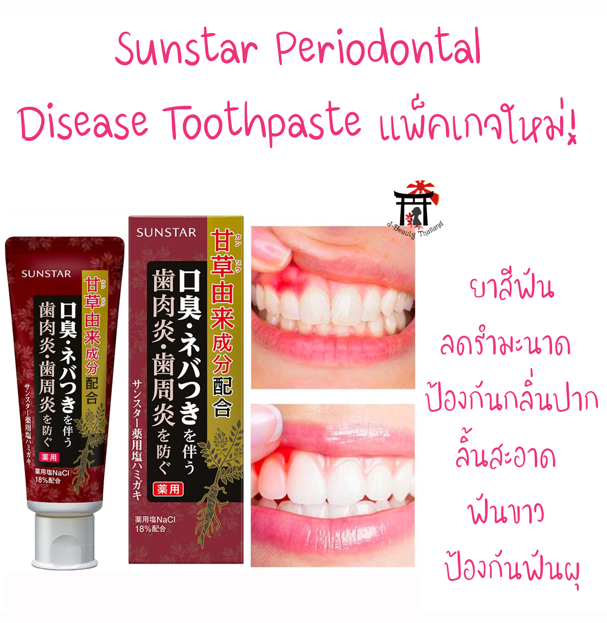Sunstar Periodontal Disease Toothpaste ยาสีฟันลดรำมะนาด ป้องกันกลิ่นปากได้ทั้งวัน ลิ้นสะอาด ฟันขาว ป้องกันฟันผุ 85 กรัม