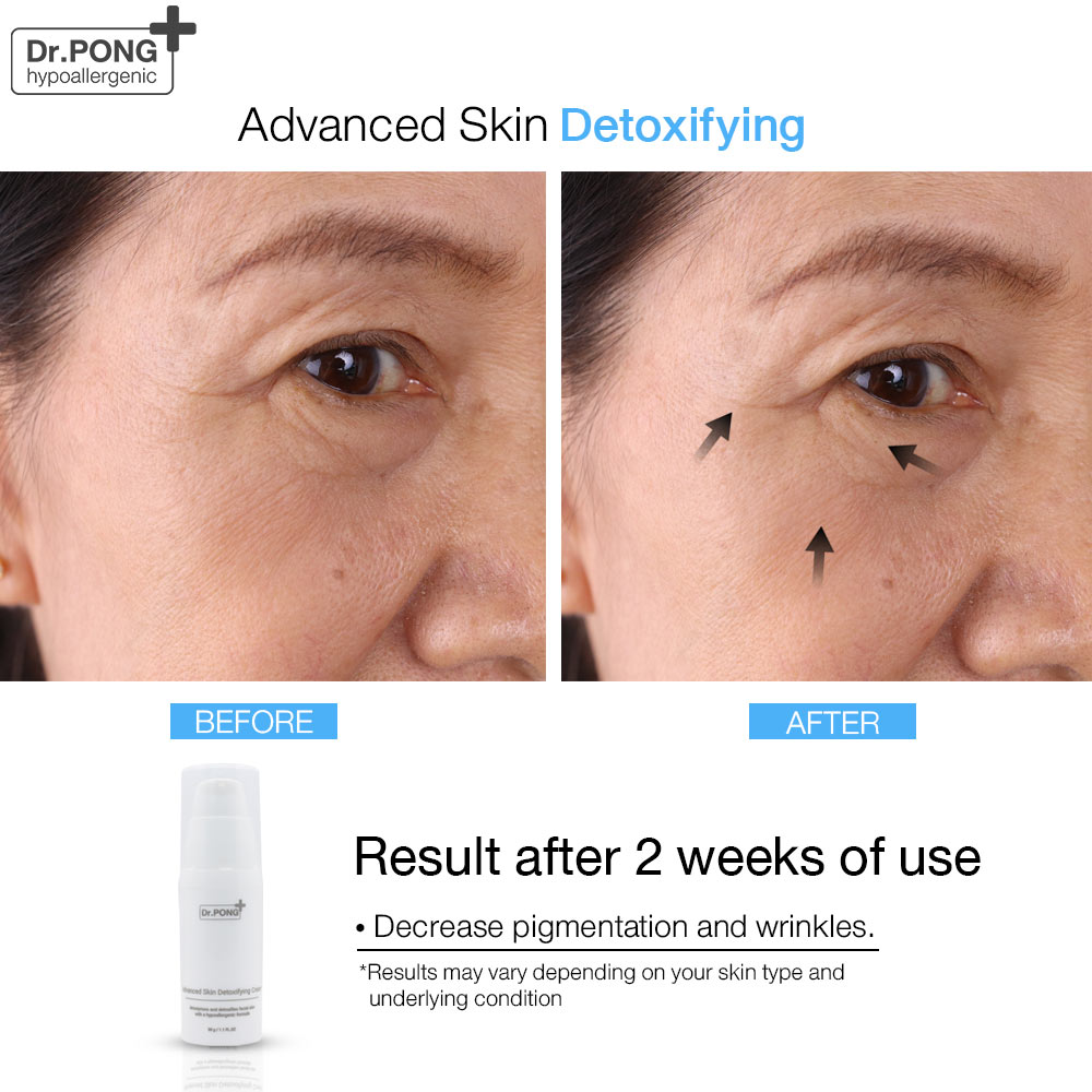 Dr. Pong Advanced Skin Detoxifying Cream - ครีมพักหน้า ครีมบำรุงผิวหน้า ครีมหน้าใส ครีมลดริ้วรอย