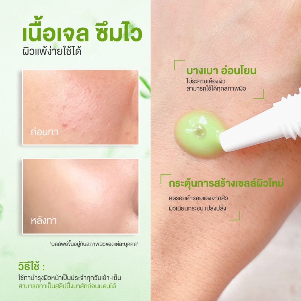 (แบบหลอด) Jula's Herb Moringa Advanced Repair Gel 40 ml. จุฬาเฮิร์บ เจลมะรุม ลดรอยดำ หลุมสิว (1 หลอด 40 มล.)
