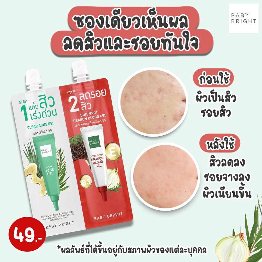Baby Bright Clear & Treat Acne Set 6G+6G เบบี้ไบร์ท ครีมซอง 2 หัว เคลียร์แอนด์ทรีทแอคเน่เซ็ท 6G+6G 2 IN 1 ครบเซ็ทจบปัญหาเรื่องสิวและรอยสิว
