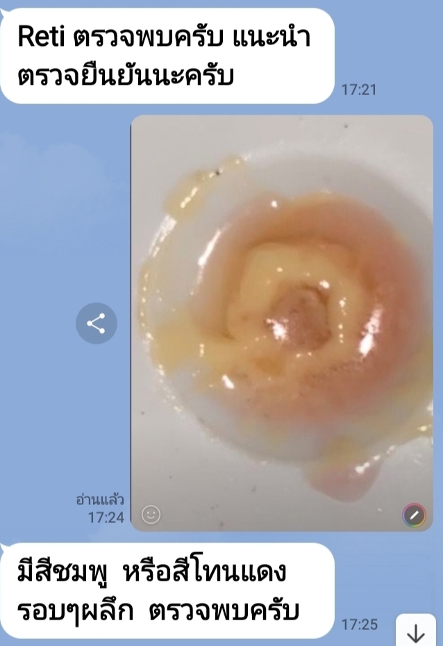 ชุดทดสอบกรดเรทิโนอิค(กรดวิตามินA)ในเครื่องสำอาง 25 ตัวอย่างต่อ กล่อง