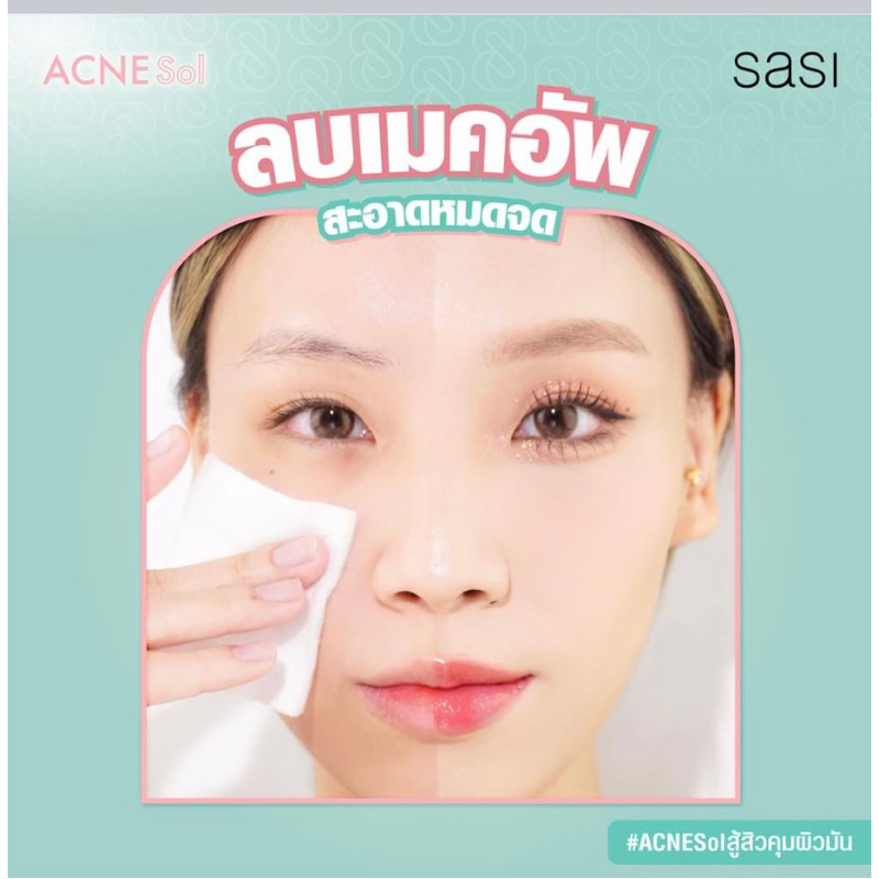 SASI Acne Sol Micellar Cleansing Water 100 ml. Sasi ศศิ แอคเน่ โซล ไมเซลล่า คลีนซิ่ง วอเตอร์ 100 มล. ไมเซลล่าลบเมคอัพ สำหรับผิวเป็นสิว