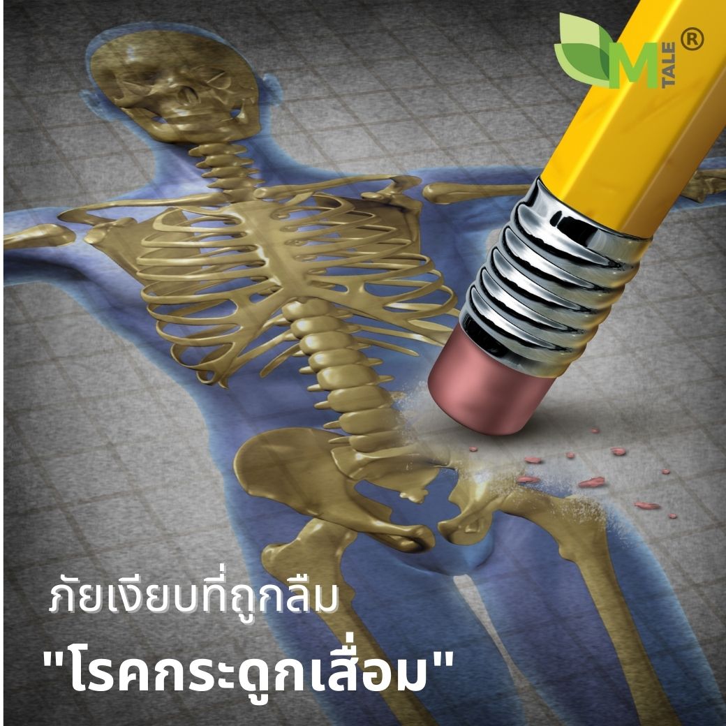 M TALE CALLAGEN ตัวช่วยโรคกระดูกเสื่อม