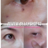 รีวิว กำจัดติ่งเนื้อ ใต้ตา ง่ายๆด้วยตนเอง โดยครีมกำจัดไฝ ขี้แมลงวัน กระ ติ่งเนื้อ by lilyshop43 (ผลลัพธ์ขึ้นอยู่กับสภาพผิวส่วนบุคคล)