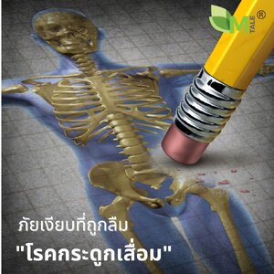 "โรคกระดูกเสื่อม” กับตัวช่วย M TALE CALLAGEN